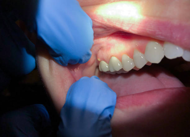 Best Cosmetic Emergency Dentistry in Maiden, NC