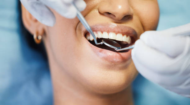 Best Same-Day Emergency Dental Services in Maiden, NC