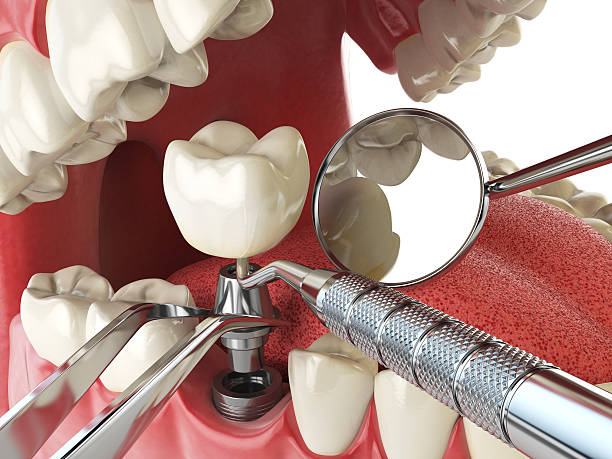 Best Emergency Denture Repair in Maiden, NC