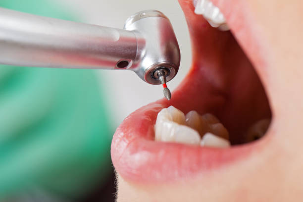 Best Emergency Treatment for Dental Infections or Abscesses in Maiden, NC